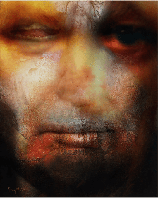 david-feingold-bruise